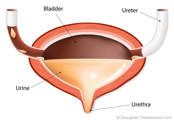Fast Bladder Bladder Control and Diet Changes